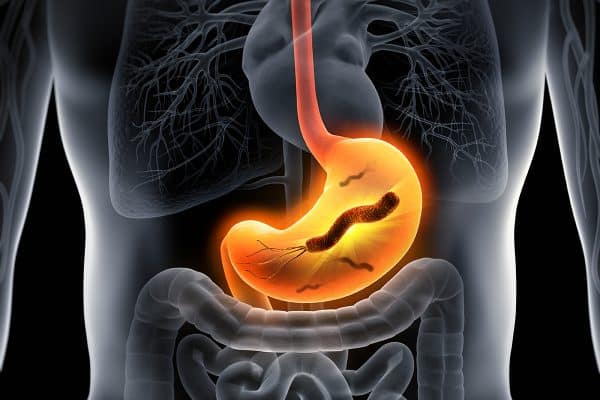 Étude des transporteurs de nickel chez Helicobacter pylori