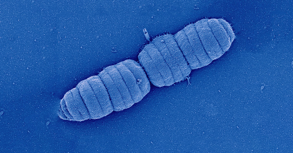 Image de microscopie électronique à balayage de la bactérie Simonsiella muelleri (de la famille des Neisseriaceae) ressemblant à une chenille. 