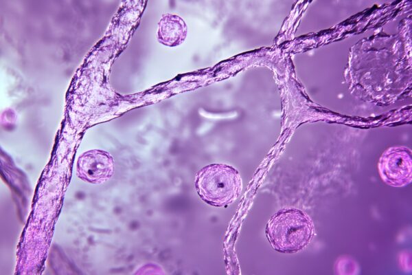 Identification de pathogènes viraux et bactériens subvertissant les kinases RSK grâce à un court motif linéaire