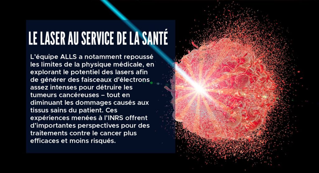 Le laser au service de la santé
L’équipe ALLS a notamment repoussé les limites de la physique médicale, en explorant le potentiel des lasers afin de générer des faisceaux d'électrons assez intenses pour détruire les tumeurs cancéreuses – tout en diminuant les dommages causés aux tissus sains du patient. Ces expériences menées à l’INRS offrent d’importantes perspectives pour des traitements contre le cancer plus efficaces et moins risqués.