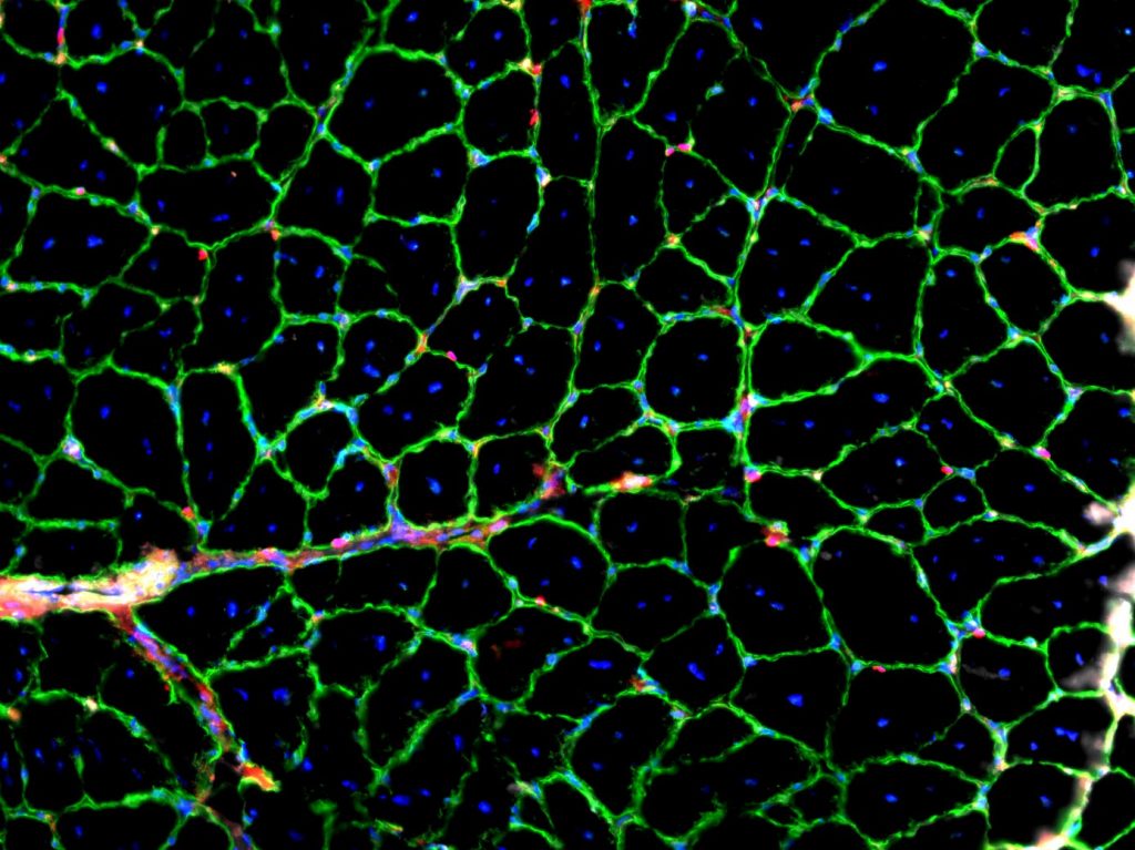 Muscle staining, photographie macro professor Marie-Claude Sincennes