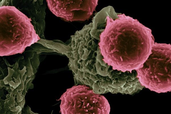 Oncofertilité : recherche de protection contre la reprotoxicité des chimiothérapies