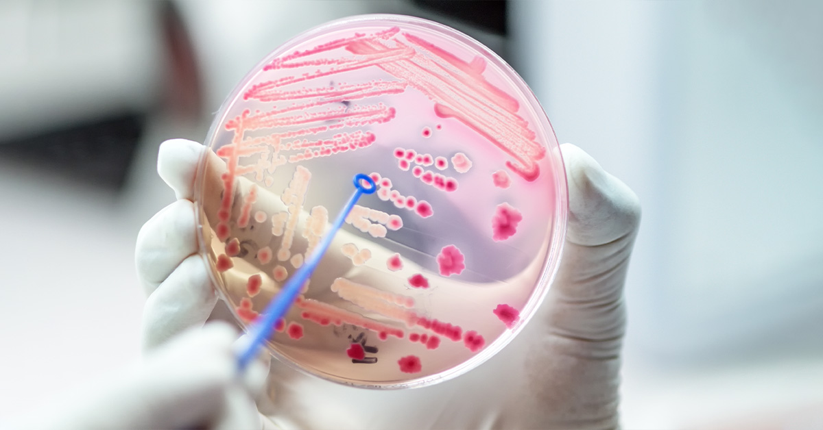 Gros plan de la plaque de milieu de culture sur des techniciens médicaux travaillant sur la culture bactérienne et la résistance aux médicaments des agents pathogènes en laboratoire.
